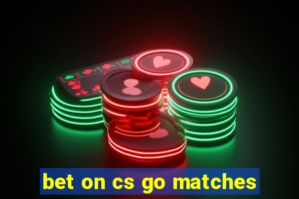 bet on cs go matches