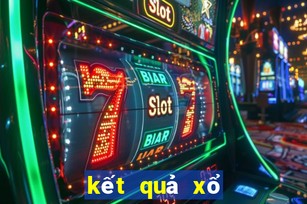 kết quả xổ số net 30 ngày