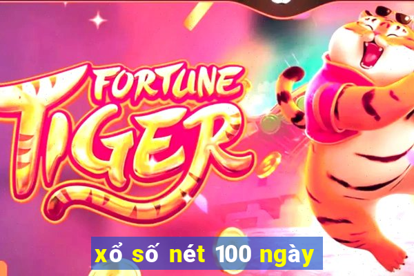 xổ số nét 100 ngày