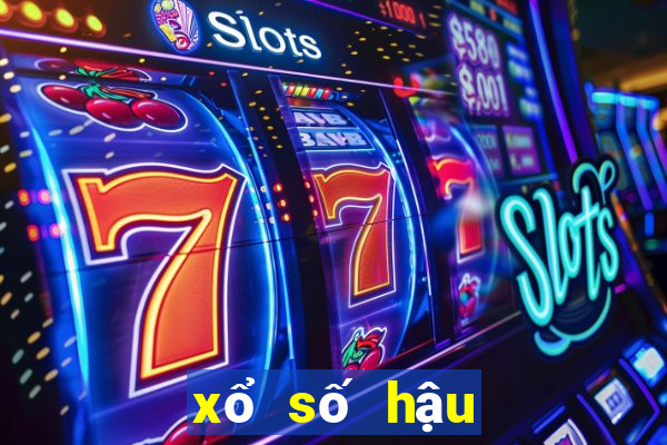 xổ số hậu giang 17 tháng 2