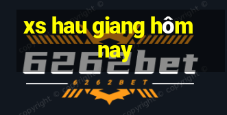 xs hau giang hôm nay