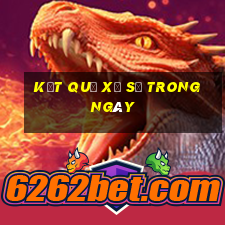 kết quả xổ số trong ngày