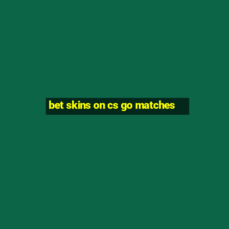 bet skins on cs go matches