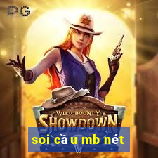 soi cầu mb nét