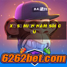 xổ số miền nam soi cầu